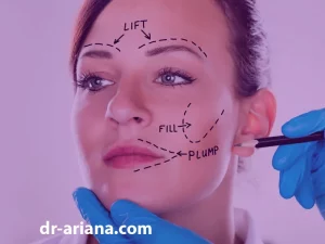 جراحی لیفت صورت