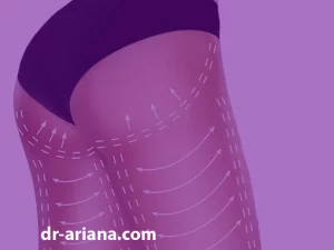 جراحی لیفت ران