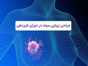 جراحی زیبایی سینه در شیردهی