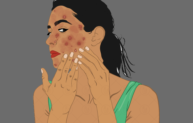 مشکلات هورمونی