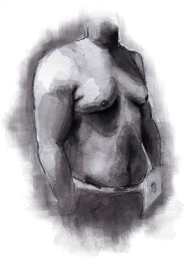 مراقبت های بعد از ژنیکوماستی