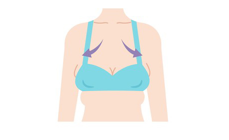 علت اصلی افتادگی سینه