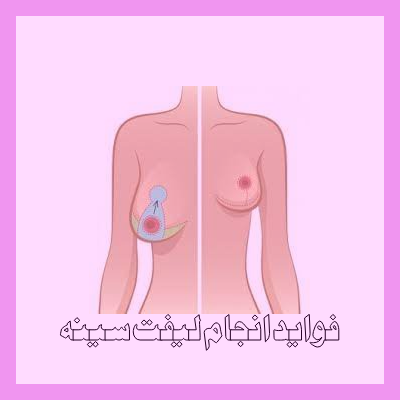 فواید لیفت سینه