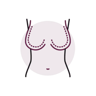 عمل ليفت و پروتز سينه همزمان