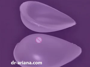 جابه جایی ایمپلنت سینه