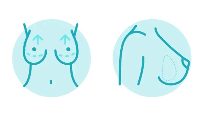 عکس-سینه-افتاده