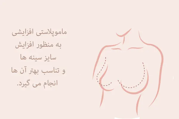 ماموپلاستی افزایشی