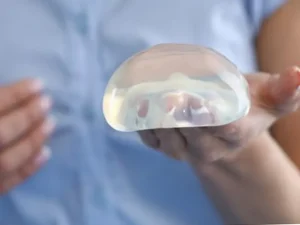 سوالات پرتکرار پروتز سینه