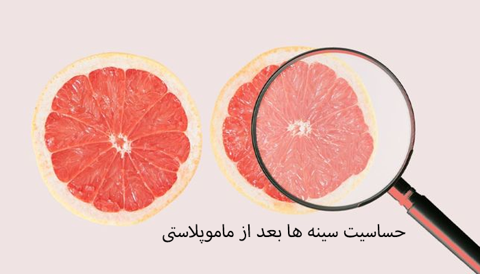 حساسیت سینه ها بعد از ماموپلاستی