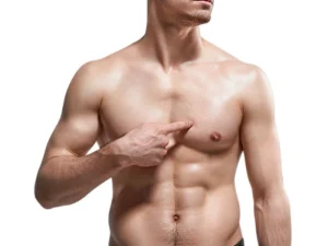 گرید های ژنیکوماستی