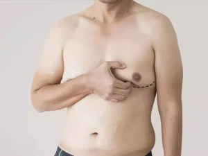 آیا ژنیکوماستی خطرناک است؟