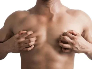 چه تست‌ و آزمایش هایی برای تشخیص دقیق ژنیکوماستی لازم است؟