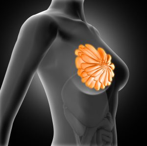 Mastectomy